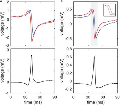 High-Resolution Measurement of Local Activation Time Differences From Bipolar Electrogram Amplitude